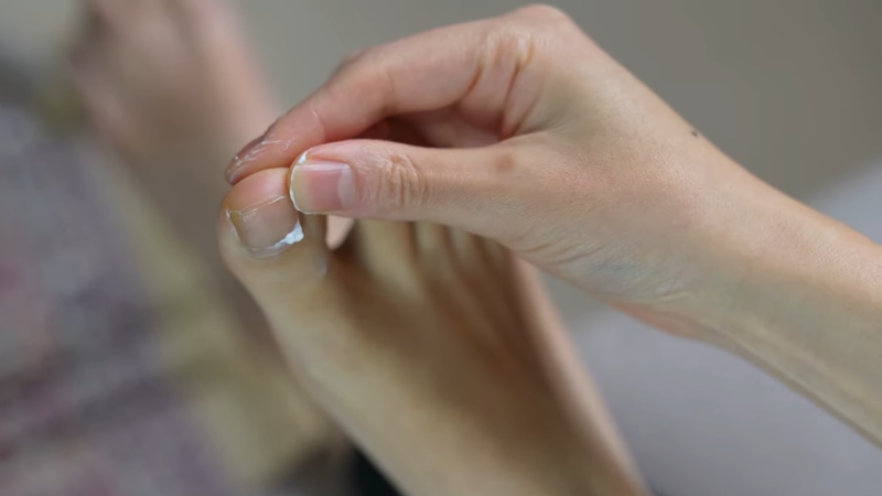 What Physical Signs Show Terbinafine Is Working? - Medicographia